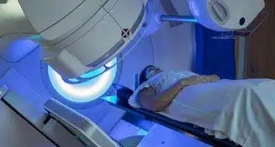 La radiothérapie dans le traitement du cancer du sein
